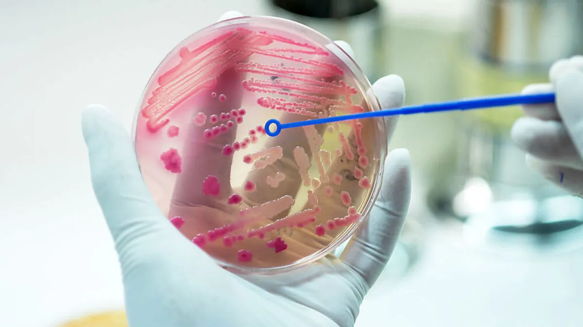 Mehr Tote als durch Herzinfarkt: So gefährlich ist die Sepsis