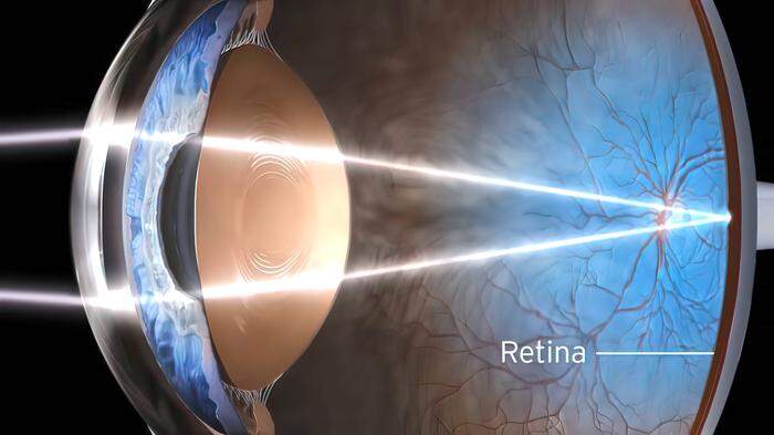 Die Retina, also die Nezhaut, liegt an der Rückseite des Augapfels