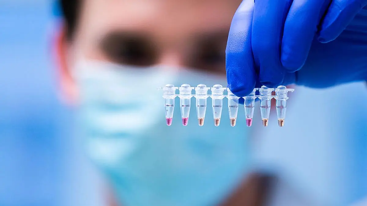 CORONAVIRUS: DEMONSTRATION DES NEUEN COVID-19-TESTVERFAHRENS ´LAMP´