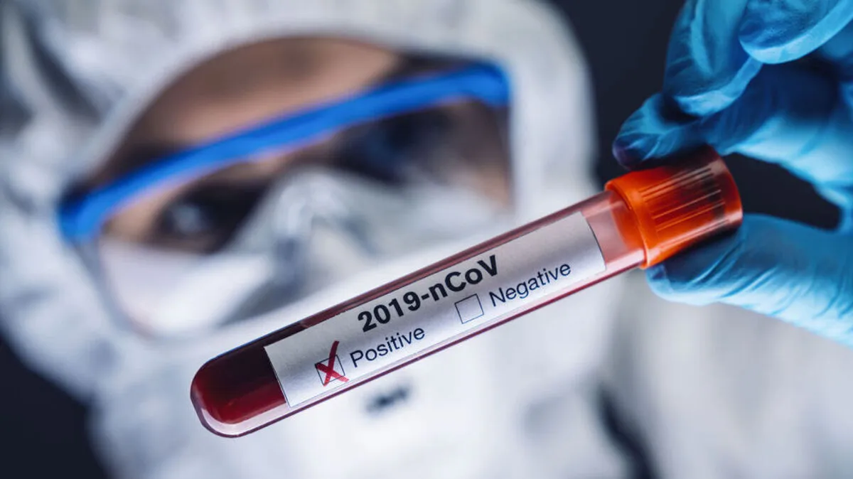 Die Infektionszahlen steigen auch in der Region weiter