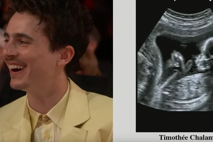 Timothée Chalamet musste im Rahmen der Oscars einiges einstecken. Moderator Conan O’Brien machte sich mehrmals über das jugendliche Aussehen des Schauspielers lustig. Der Höhepunkt waren alte Casting-Fotos der Stars, während Kollegen wie Zoë Saldaña oder Guy Pearce in jungen Jahren gezeigt wurden, ist ein angebliches Ultraschall-Bild von Chalamet zu sehen. Der Schauspieler nimmt es mit Humor.