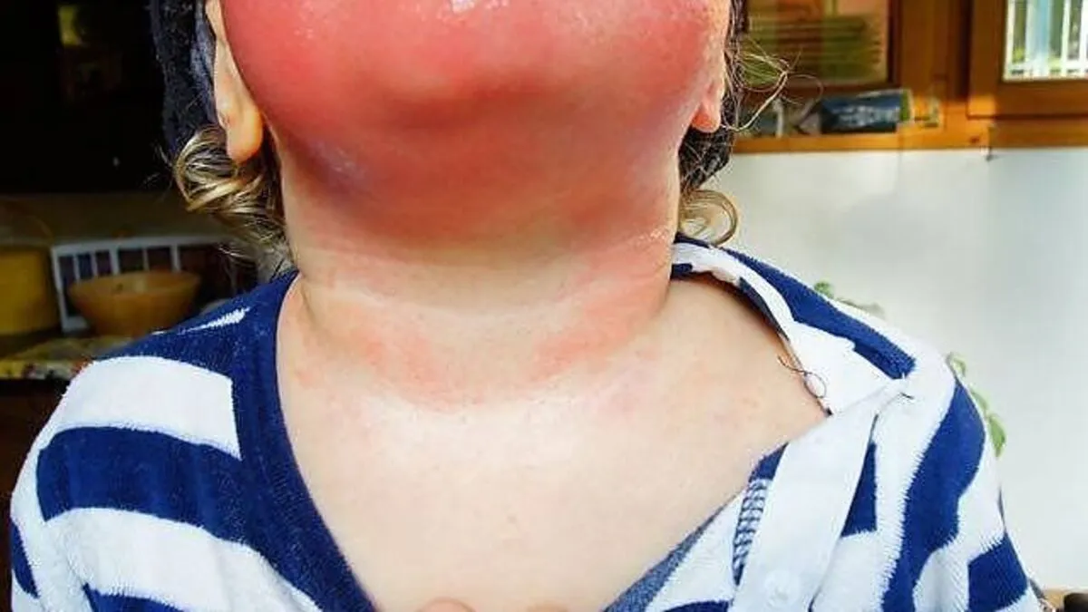 Dramatische Folgen einer Berührung