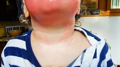 Dramatische Folgen einer Berührung