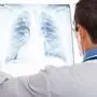 Doctor examining a lung radiography