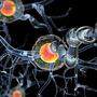 Bei Multiple Sklerose kommt es zu mehreren Entzündungsherden im zentralen Nervensystem. 