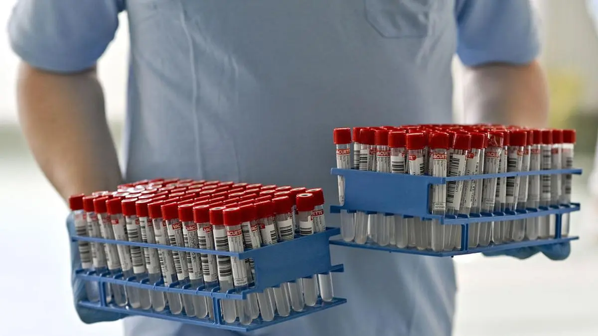 ABD0081_20210326 - WIEN - ÖSTERREICH: Corona: Ein Lifebrain-Mitarbeiter hantiert mit "Gurgel-Tests" am Freitag, 26. März 2021, im Rahmen der Eröffnung des neuen Lifebrain Logistik- und Laborzentrums "Alles gurgelt" auf der Baumgartner Höhe in Wien. - FOTO: APA/HERBERT NEUBAUER