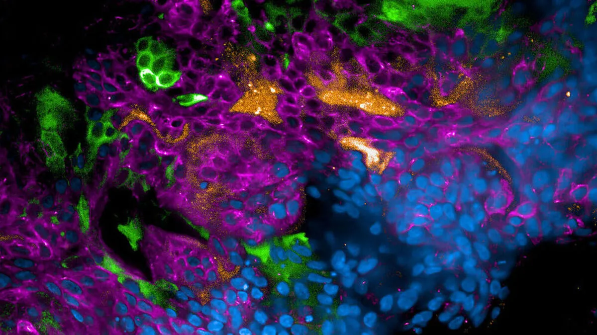 Das 3D-Modell der Lunge 