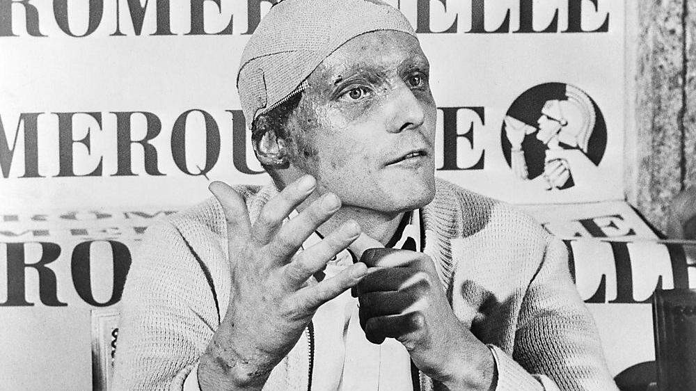 Niki Lauda, nach dem Unfall am 12. September 1976