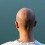Haarausfall geht vor allem bei jüngeren Männern oft mit einer großen psychischen Belastung einher (Symbolbild)