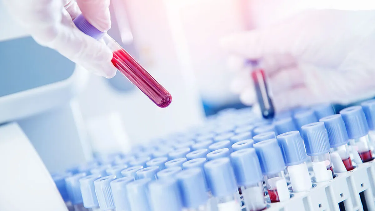 Über 200 abgesonderte Kontaktpersonen und 72 Covid-19-Fälle im Bezirk Leoben