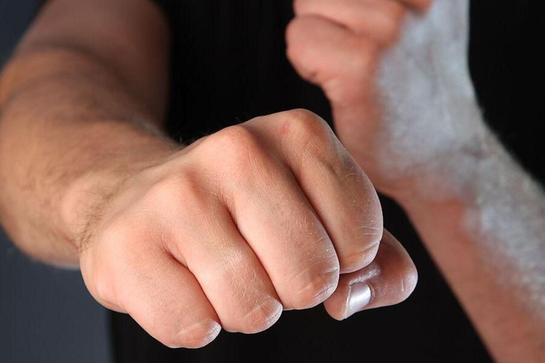 Unbekanntes Opfer: Oststeirer soll Fremden geschlagen und auf dem Heimweg selbst attackiert worden sein