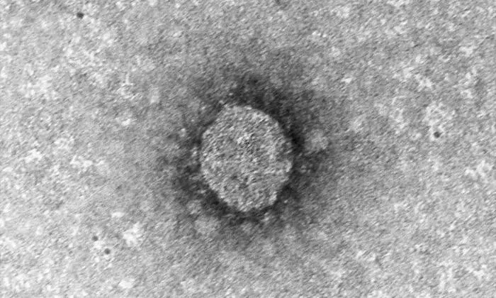 Das ist das erste Bild eines österreichischen SARS-CoV-2-Erregers, aufgenommen mit einem Elektronenmikroskop