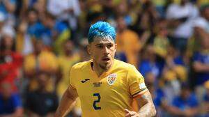Auffallen um jeden Preis! Das hat sich wohl auch der rumänische Fußballer Andrei Ratiu gedacht, als er sich die Haare in knalligem Blau färbte.
