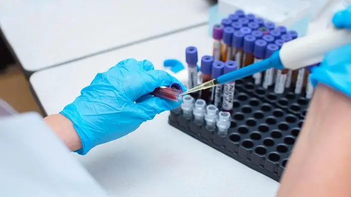 Bei der Aidshilfe Steiermark kann man sich auf HIV und auch auf andere Geschlechtskrankheiten testen lassen. 
