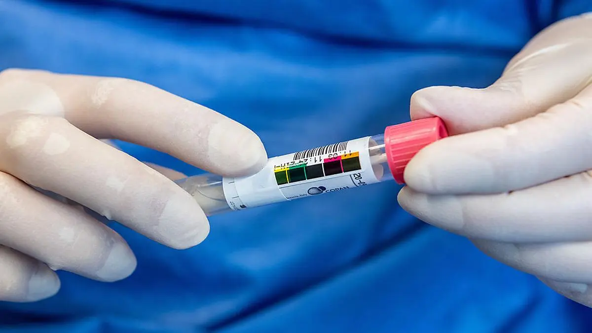 Kärnten hat eine Inzidenz über 3000 