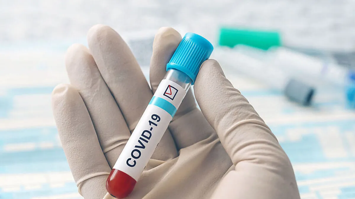 Doctor hand holding test tube with blood for 2019 - nCoV analyzing in laboratory. Novel Coronavirus originating in China. Coronavirus blood test concept. Development of vaccine against the virus.