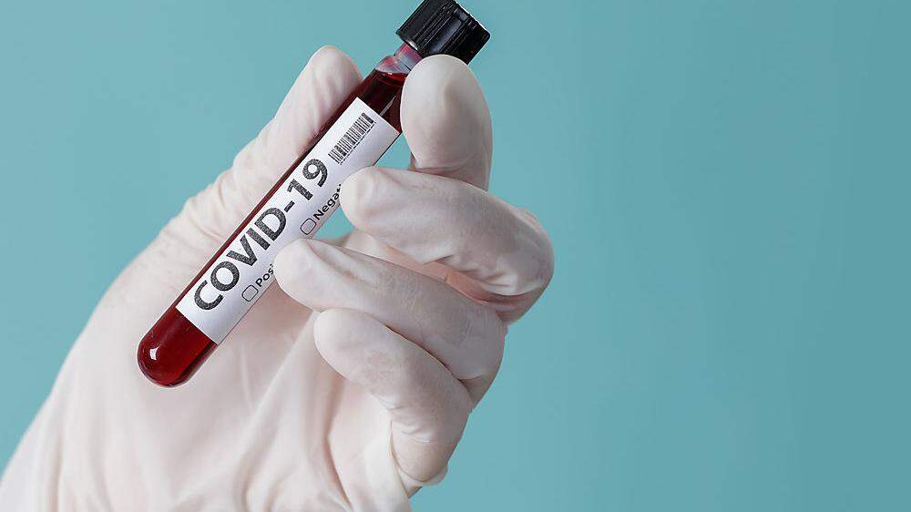 22.532 Covid-Infektionen wurden in Kärnten durch PCR-Tests bestätigt