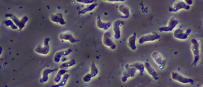 Der Parasit Naegleria fowleri wird umgangssprachlich als hirnfressende Amöbe bezeichnet