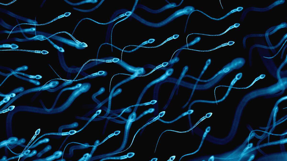 Spermien: Der schnellste Schwimmer gewinnt und kann die Eizelle befruchten. Doch ist ein bestimmtes Gen defekt, sind betroffene Männer unfruchtbar
