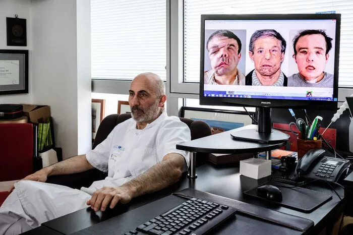 Hamons Arzt, Prof. Laurent Lantieri, ein Spezialist für Hand- und Gesichtstransplantationen. Auf dem PC-Bildschirm sieht man Hamon vor der ersten Operation, mit seinem zweiten sowie heute mit seinem dritten Gesicht.