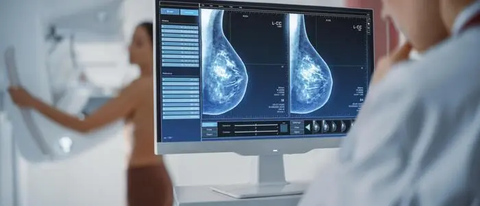 Mammografie-Untersuchungen sind weit verbreitet. In Österreich werden Frauen ab 45 Jahren regelmäßig zur Mammografie eingeladen.
