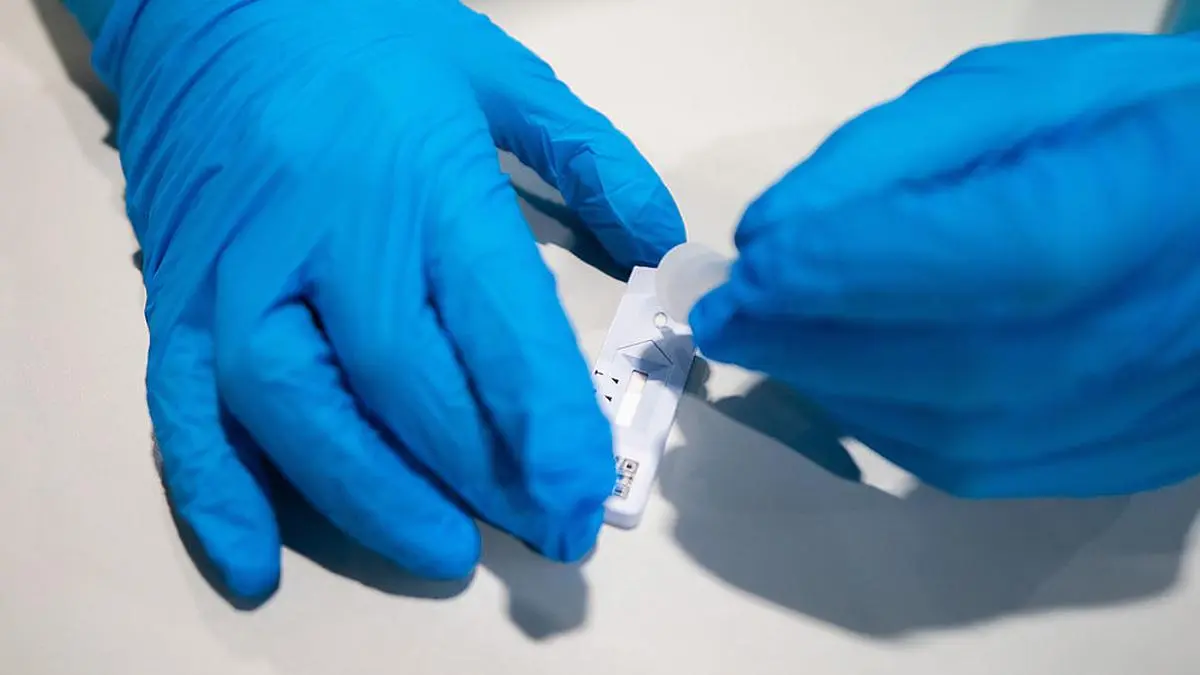 Derzeit fallen wieder sehr viele Testergebnisse positiv aus (Sujetbild)