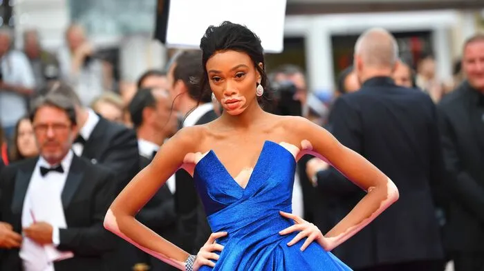 Das kanadische Model Winnie Harlow erschien zur Vorführung von Loveless" (Nelyubov) vom russischen Regisseur Andrei Zvyagintsev in einer traumhaften nachtblauen Robe.