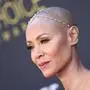 Jada Pinkett Smith redet öffentlich über ihre Erkrankung