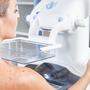 Ab dem 40. Lebensjahren sollten Frauen regelmäßig zur Mammografie