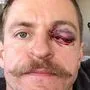 Michael Grabner erwischte es heftig