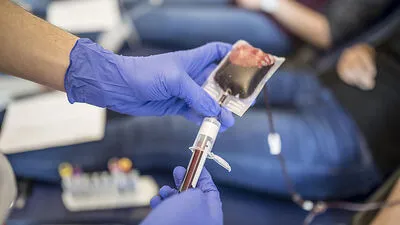 Ein 86-jährige Frau wurde durch eine Blutkonserve mit Malaria infiziert und starb 