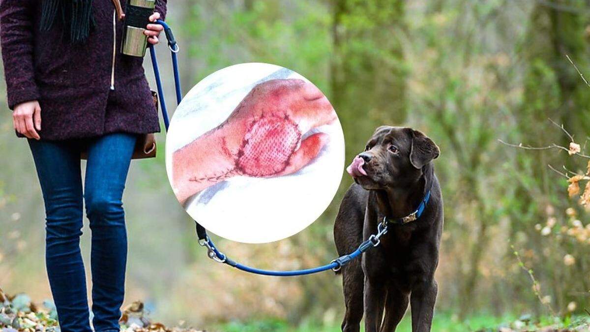 Die Leine war zu lang (Symbolbild). Das kleine Bild zeigt die Wunde des Betroffenen, bei der es zu Komplikationen kam