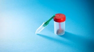 Mikrobiom-Tests für zu Hause: Experten sehen „keinen Nutzen“ 