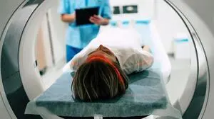 Wie die KI bei der Behandlung des Schlaganfalls hilft 