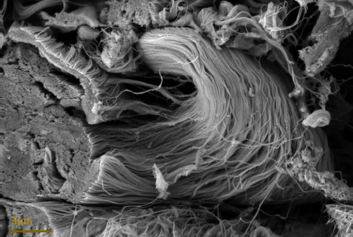 So sehen Kollagenfasern unter dem Elektronenmikroskop aus 
