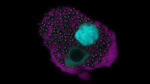Eine mit dem Naegleriavirus infizierte Amöbenzelle | Eine mit dem Naegleriavirus infizierte Amöbenzelle