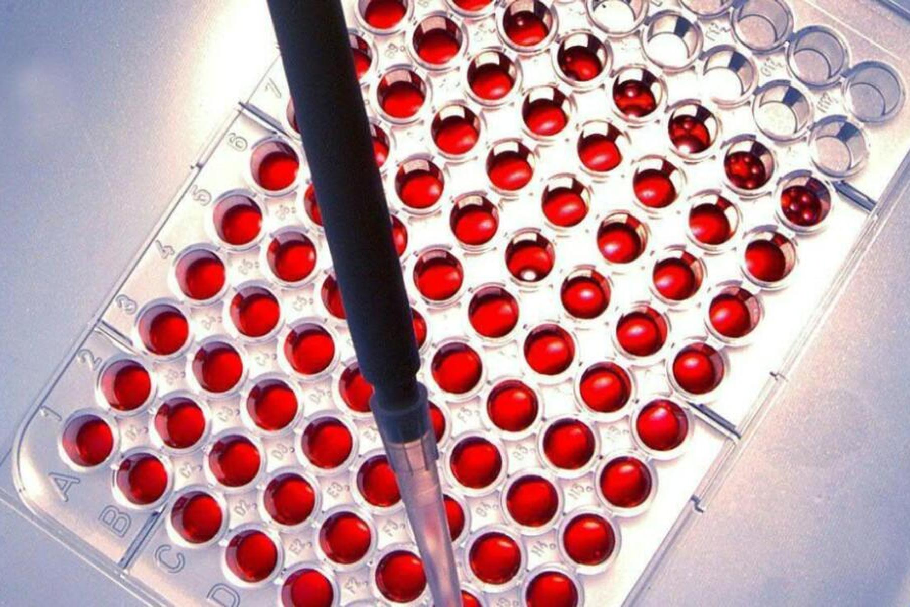 Wien: Wie ein "Held" namens "Spop" aggressiven Blutkrebs stoppt