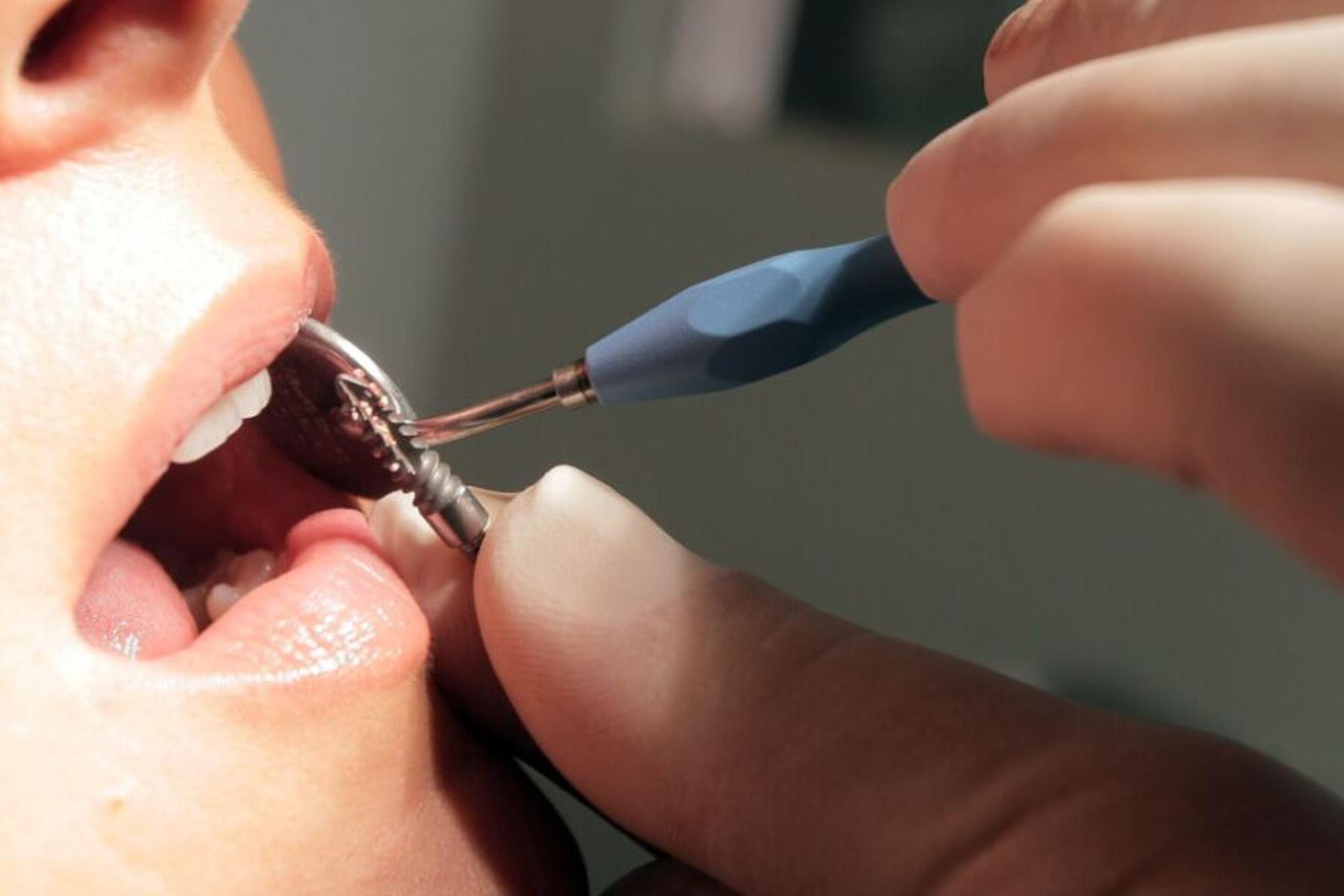 Wien: Diversion für wegen Körperverletzung angeklagten Zahnarzt