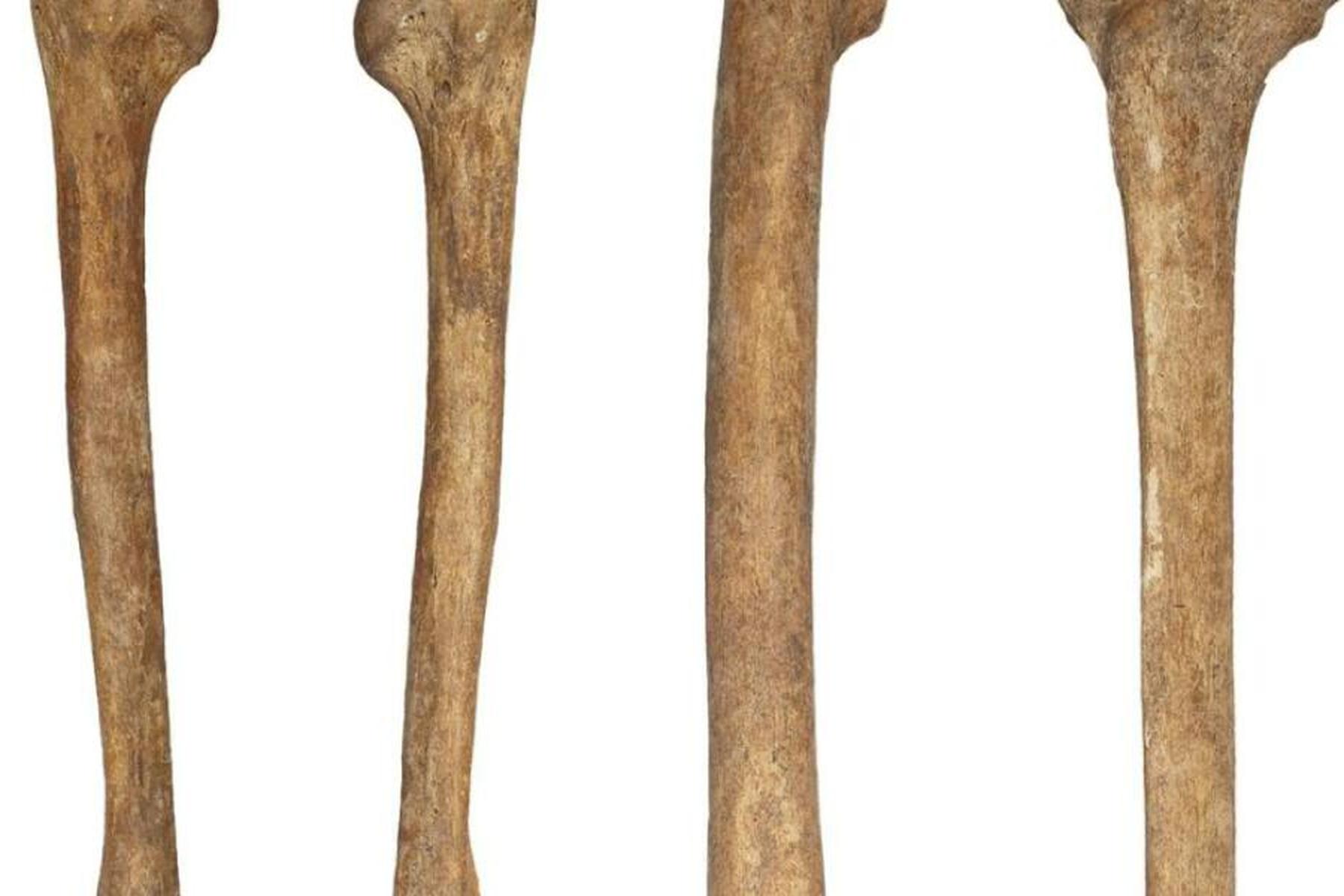 Wien/Prag: Sehr alte Knochen zeigen vermeintlich moderne Veränderungen