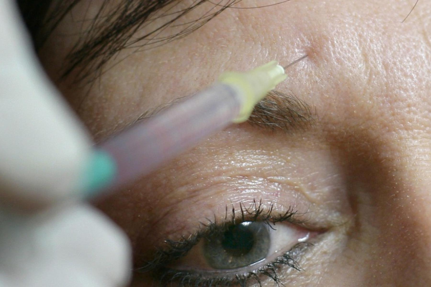 Wels: Welser Prozess wegen Kurpfuscherei bei Beautyeingriffen