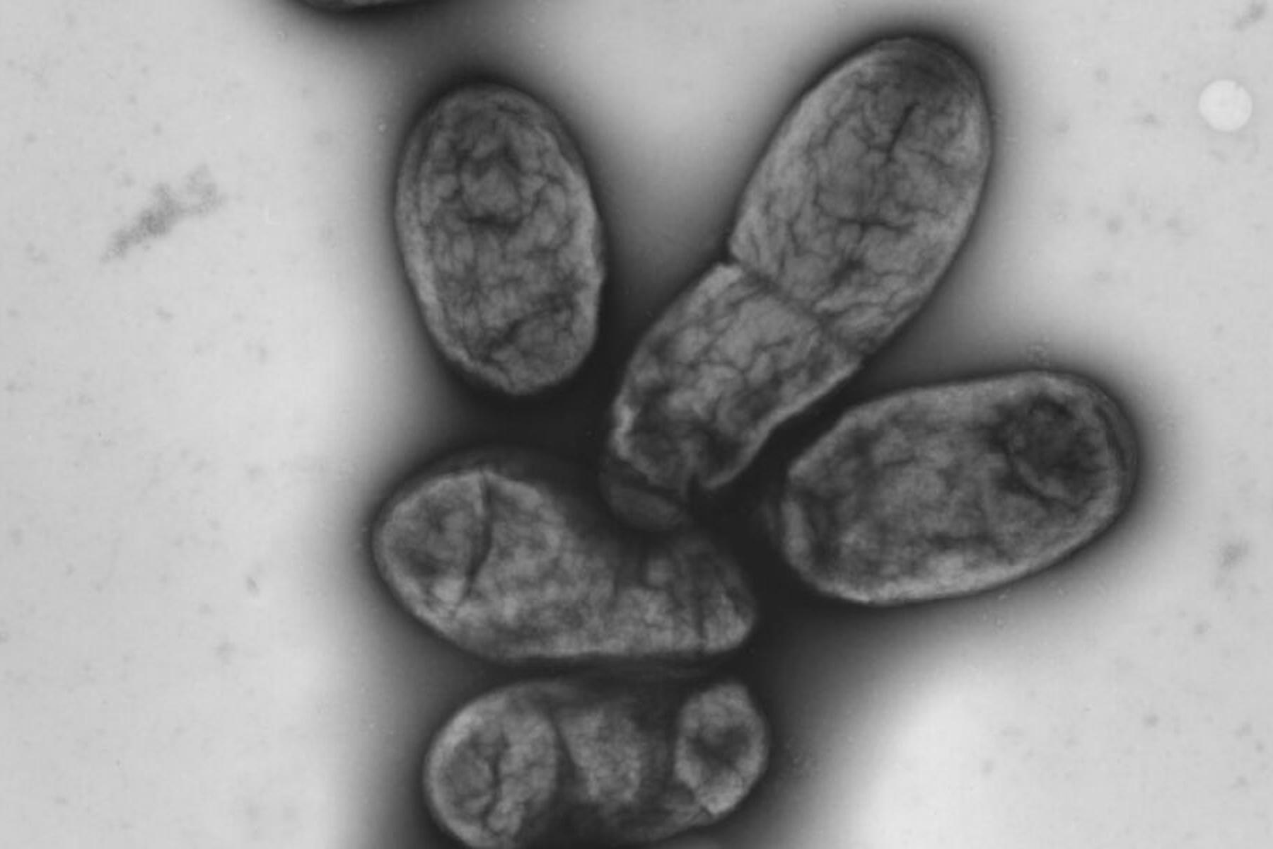 Wien: Forscher grenzen Ursprung der "Justinianischen Pest" ein