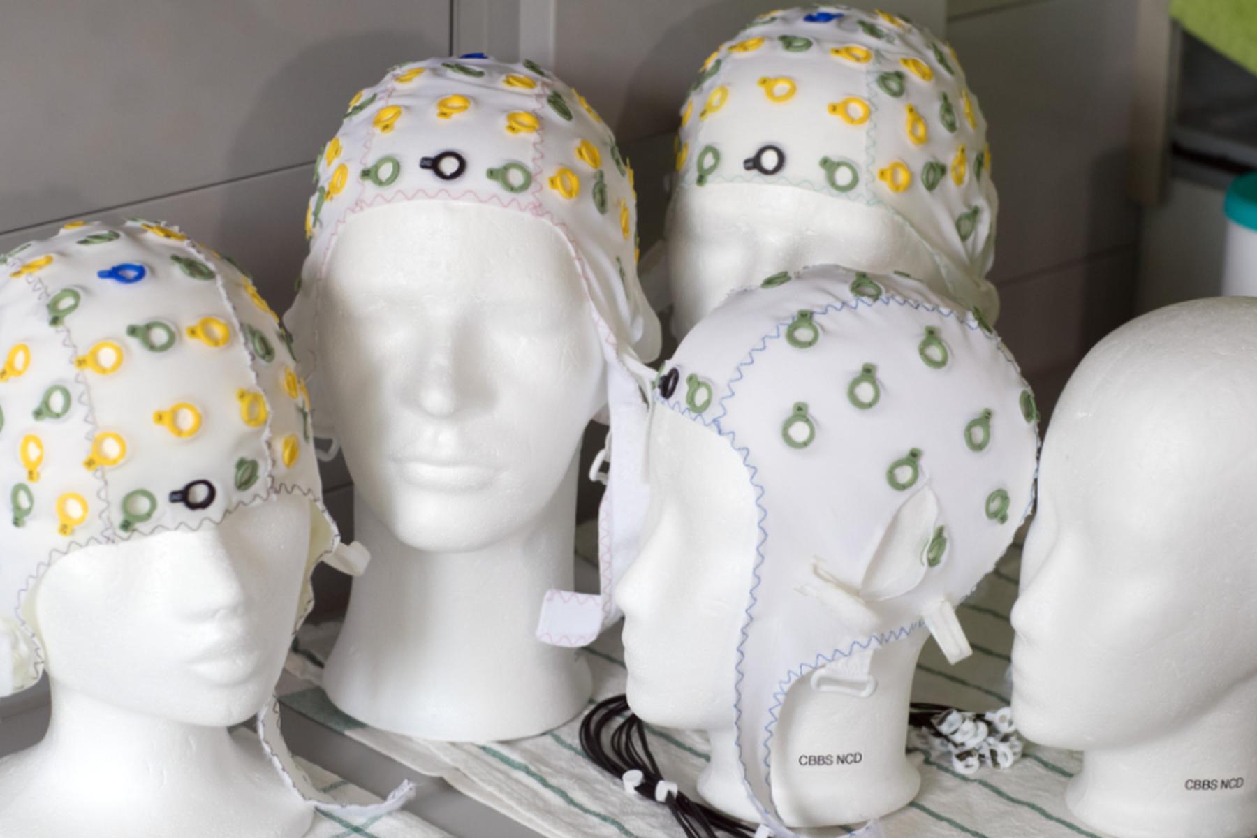 Cambridge: Gehirnstruktur durchläuft fünf Phasen