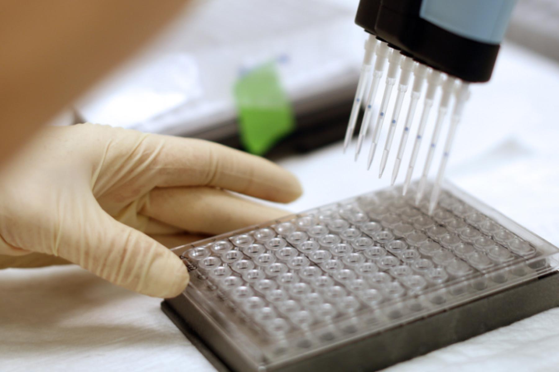 Raziskovalci iz Gradca odkrili molekularni signal za zdravljenje izgube teže pri bolnikih z rakom