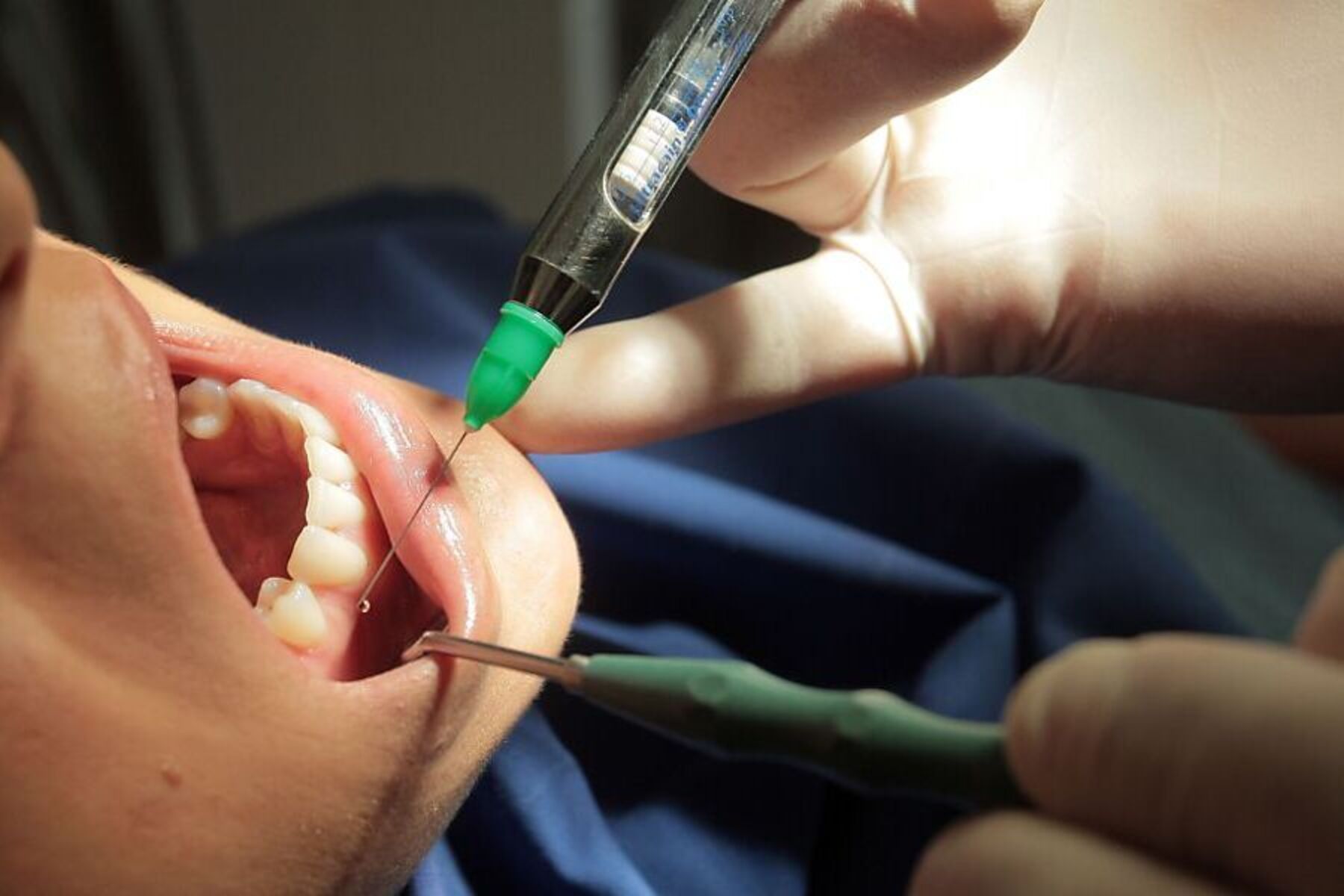 Zahnarzt vor Gericht: Gutachter zum Verteidiger: „Halten Sie den Mund“