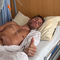 Benji Karl hatte sich das Schlüsselbein gebrochen