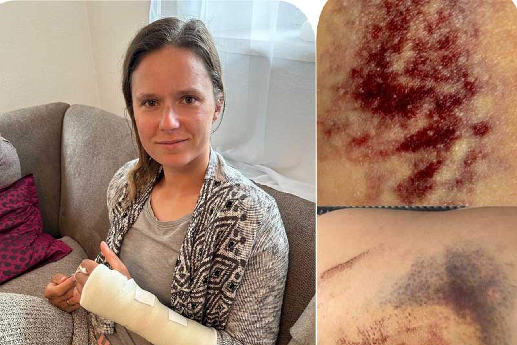 Mit 50 km/h gegen Autotür: Vanessa Herzog nach Rad-Verkehrsunfall: „Es war ein Schock“