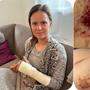 Vanessa Herzog erholt sich daheim in Ferlach von ihrem Unfall