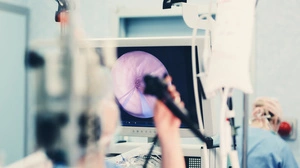 Darmkrebs: Vorsorge startet, aber es mangelt an Kassenärzten 