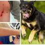 Ein größerer schwarzer Hund biss die beiden Buben, die Wunden sind dokumentiert