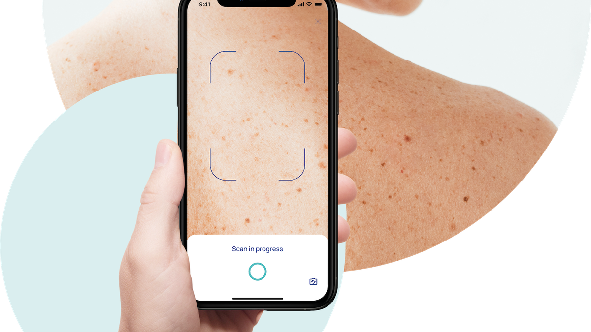 SkinScreener: Hautveränderungen per App screenen und eine Risikoeinschätzung erhalten 